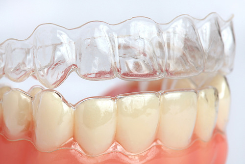 invisalign treatment